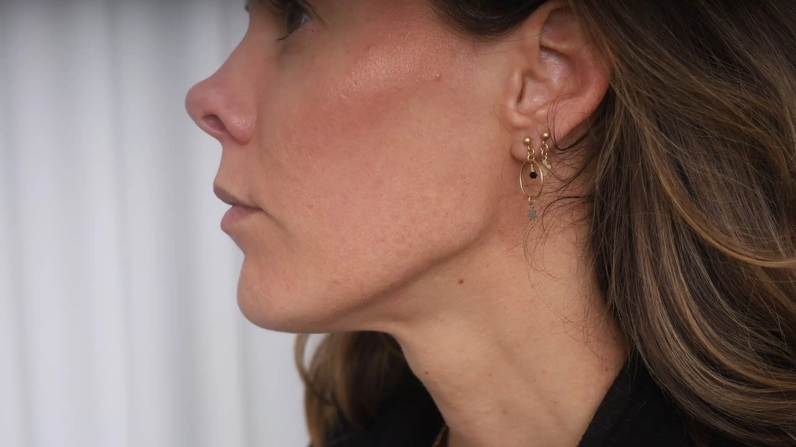 Lower face contouring consultations Sydney and Brisbane