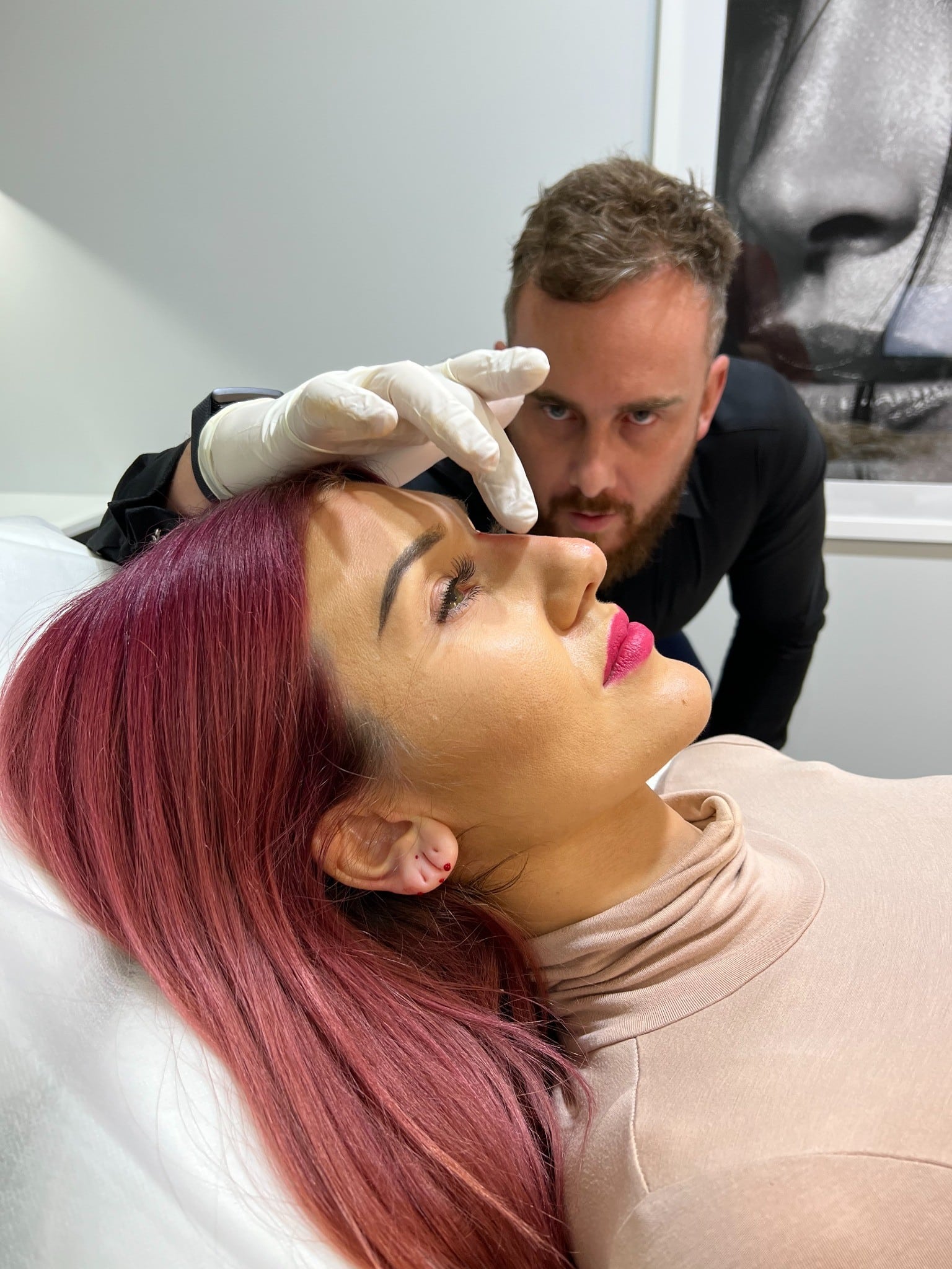 Nose threadlift sydney