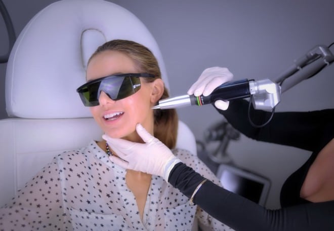 Melasma removal Sydney