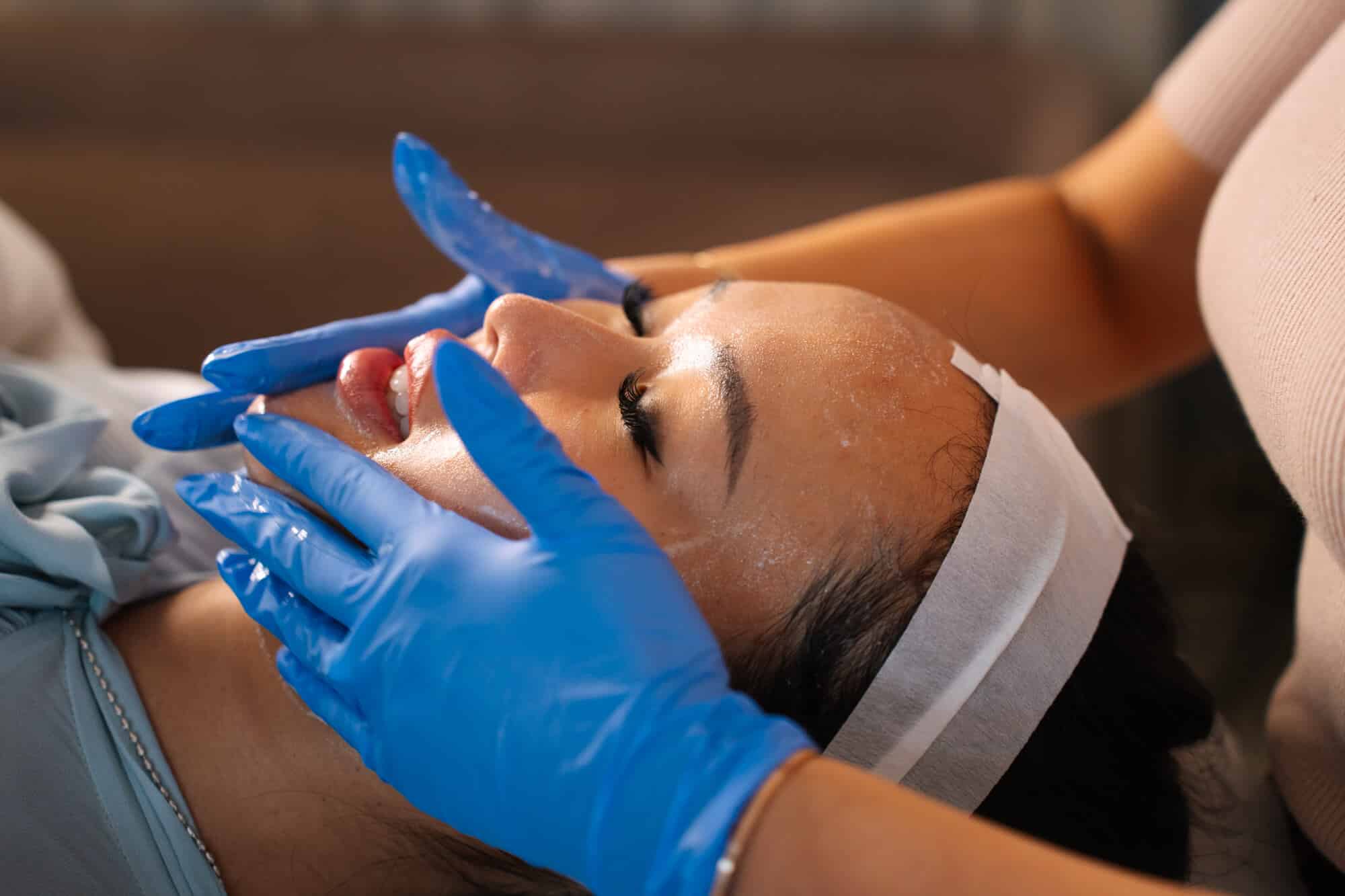 How do chemical peels work for pigmentation?