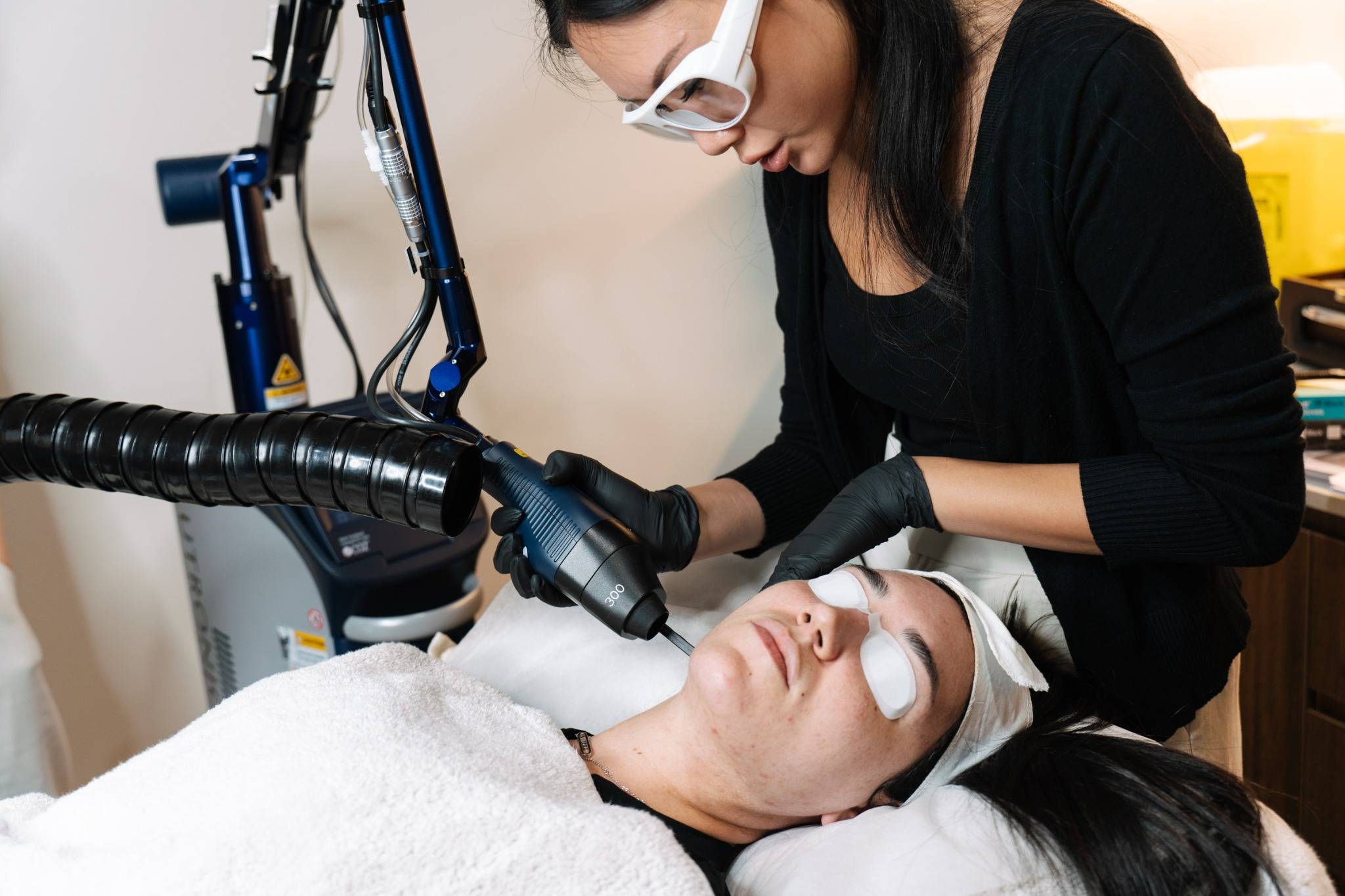 Active acne laser treatment sydney