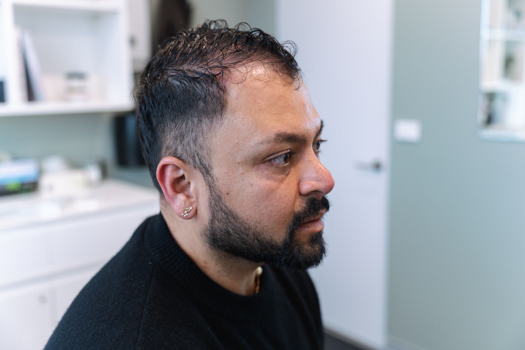 Hair restoration options Sydney with cosmetic doctors at Contour Clinics 