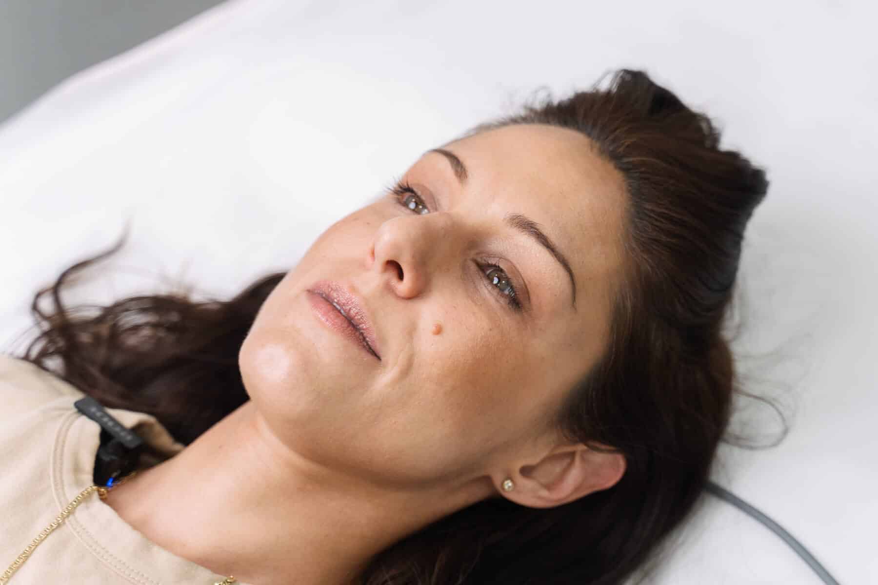 Mole removal Sydney - how it works