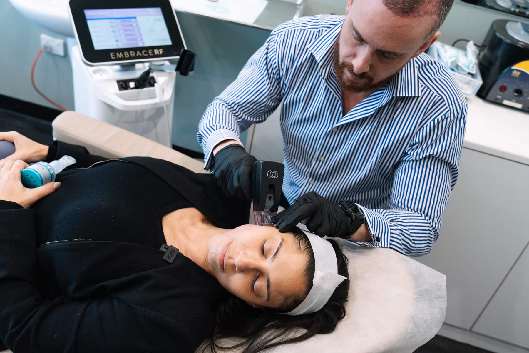 Morpheus 8 Laser Skin Needling Sydney