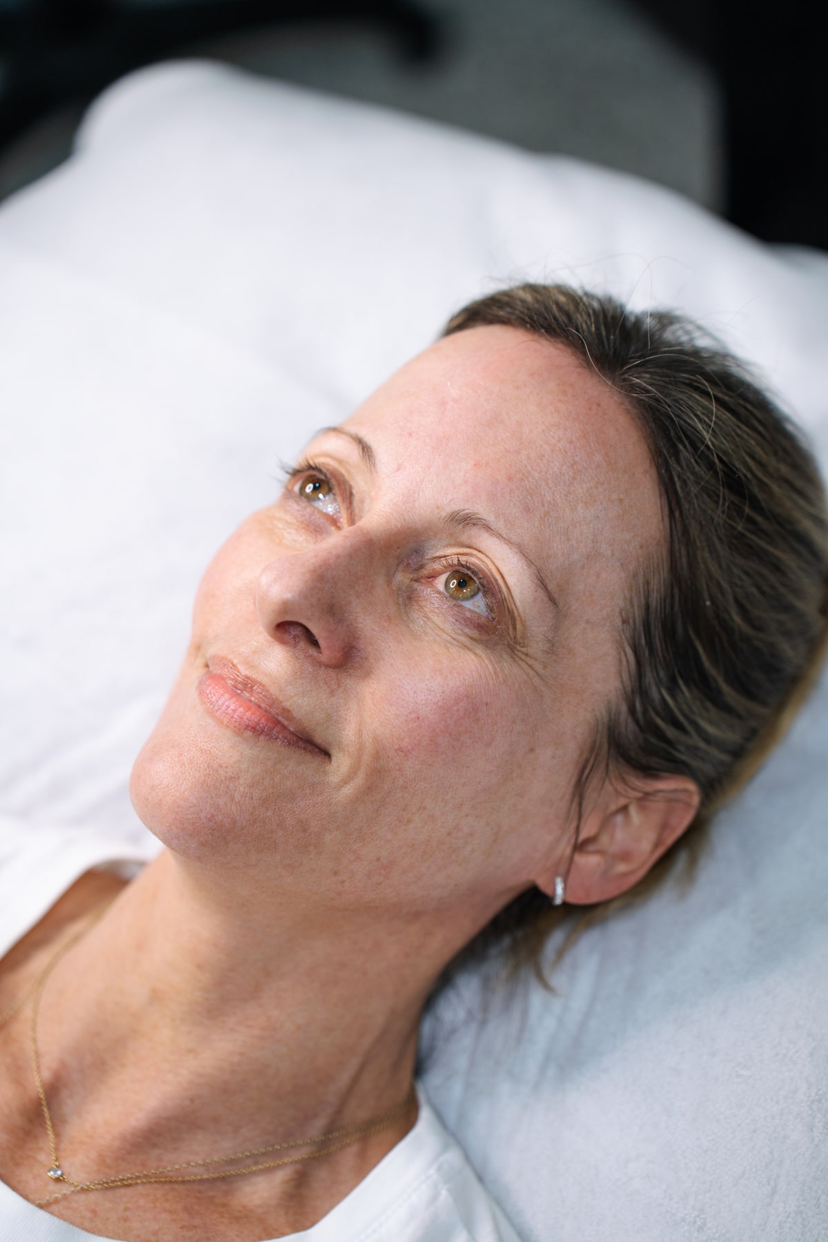 Collagen Stimulation Injections explained