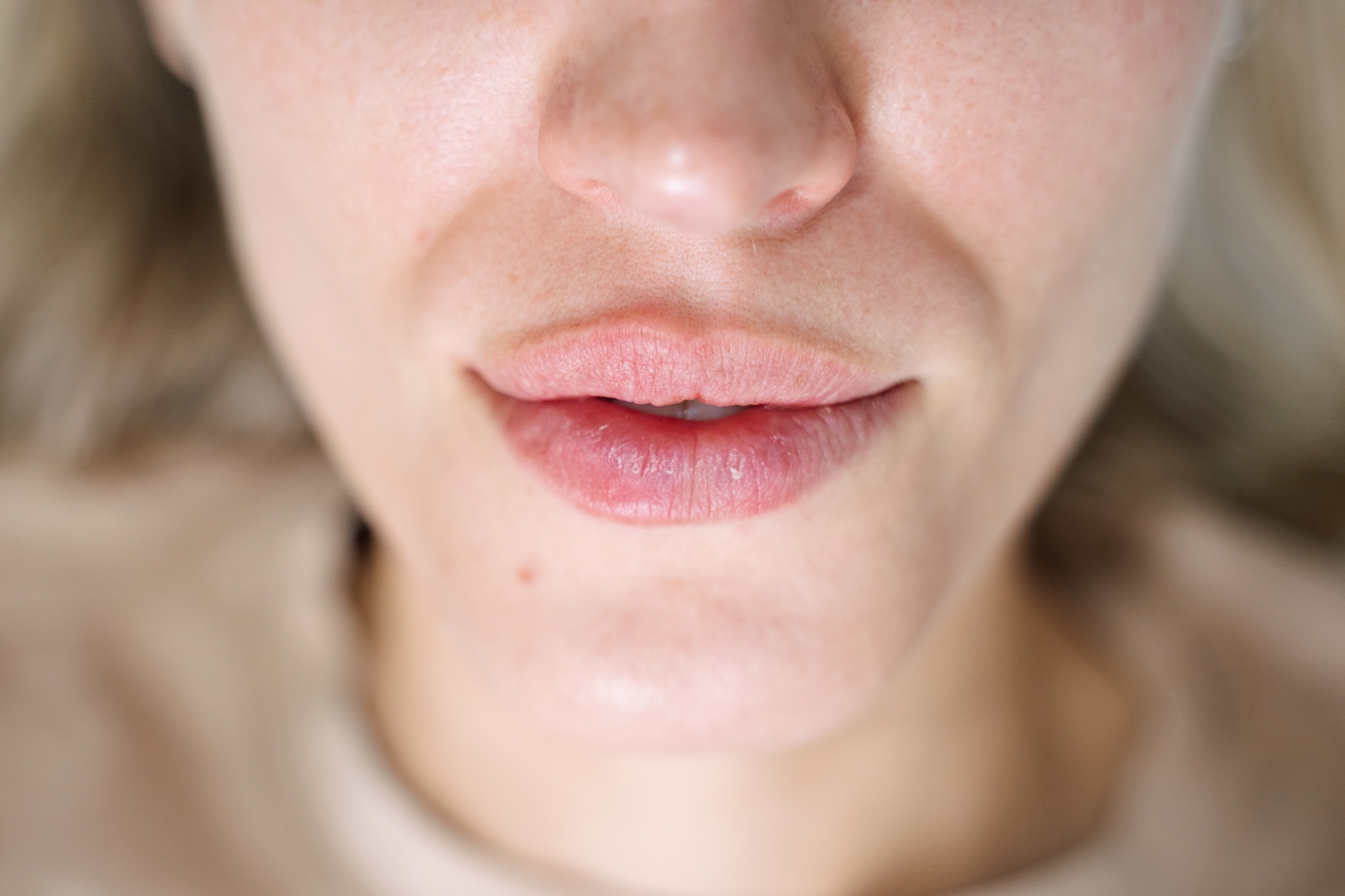 Rejuran treatment for lips Sydney by Contour Clinics