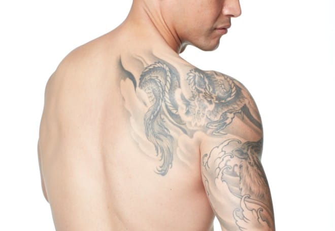 Laser tattoo removal sydney least painful