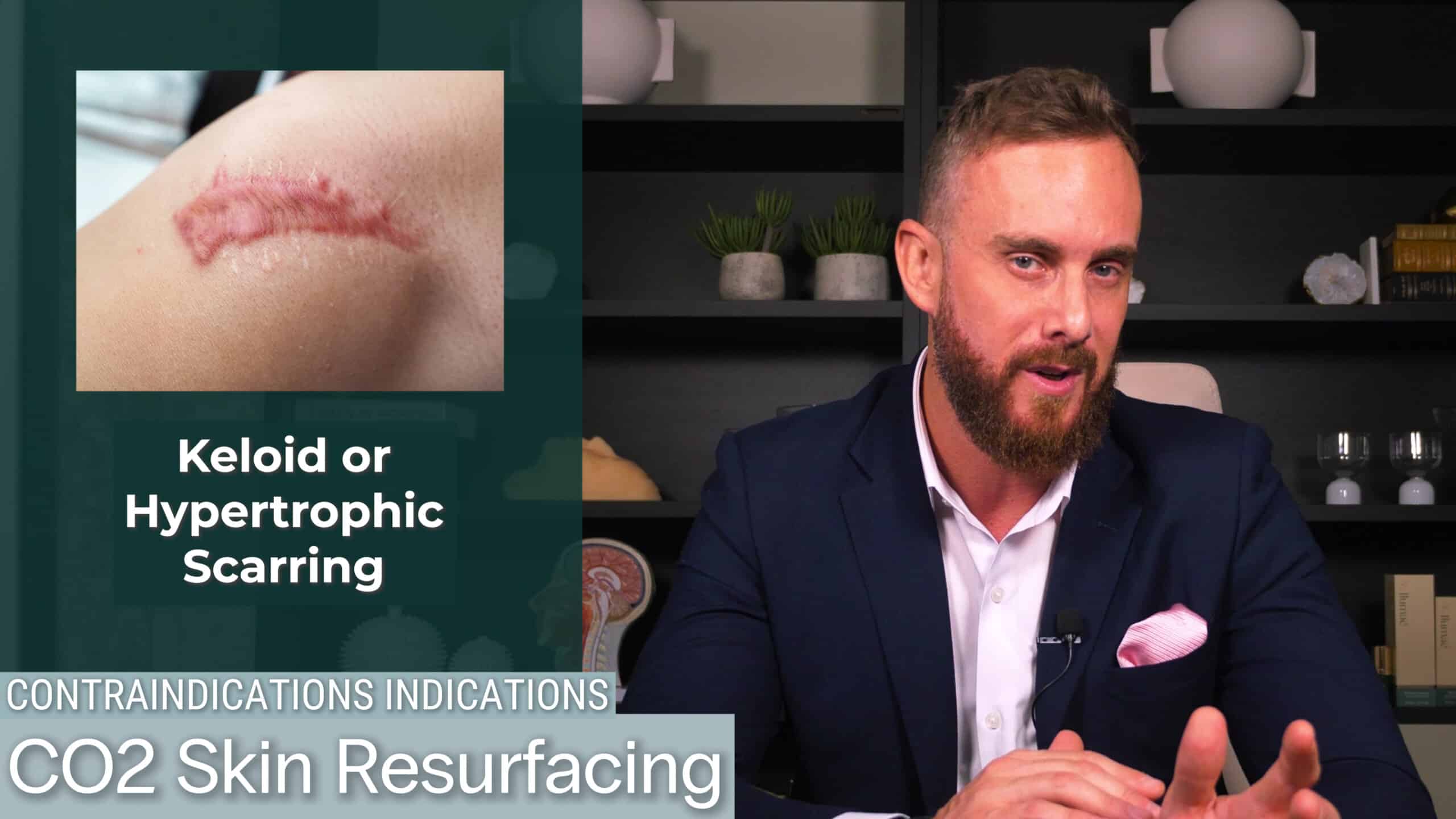 Image is not available