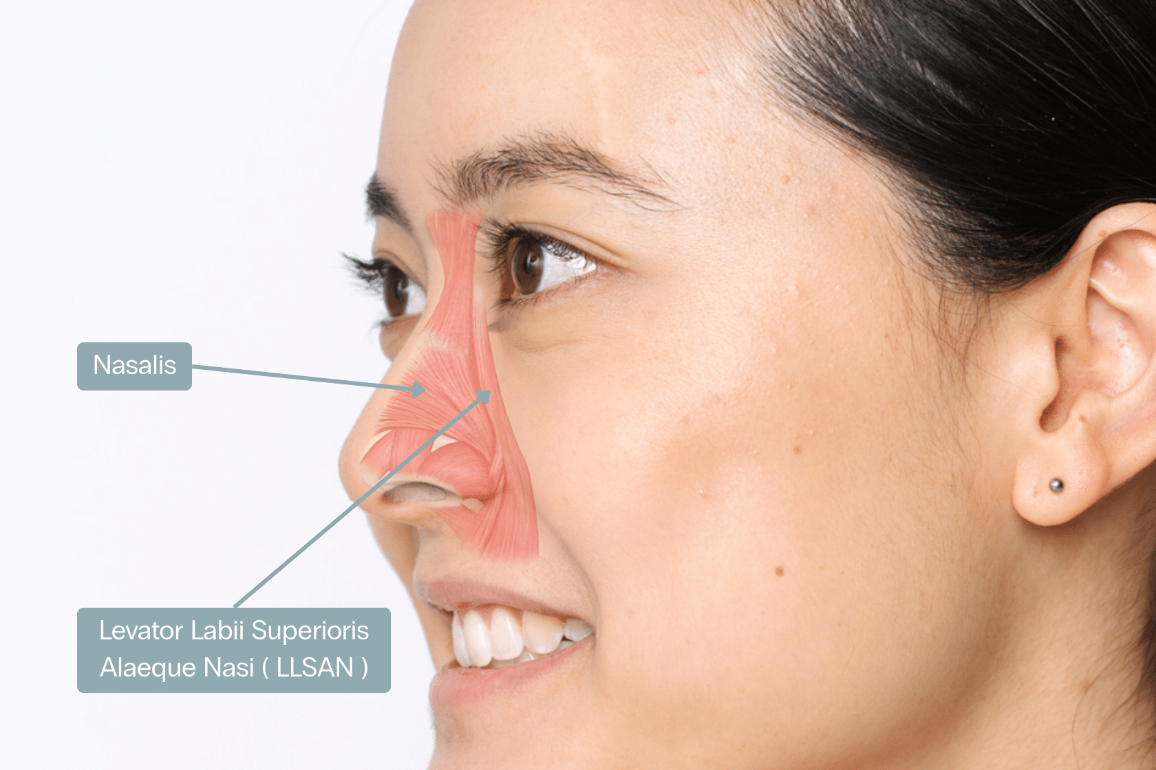 Gummy smile treatment anatomy