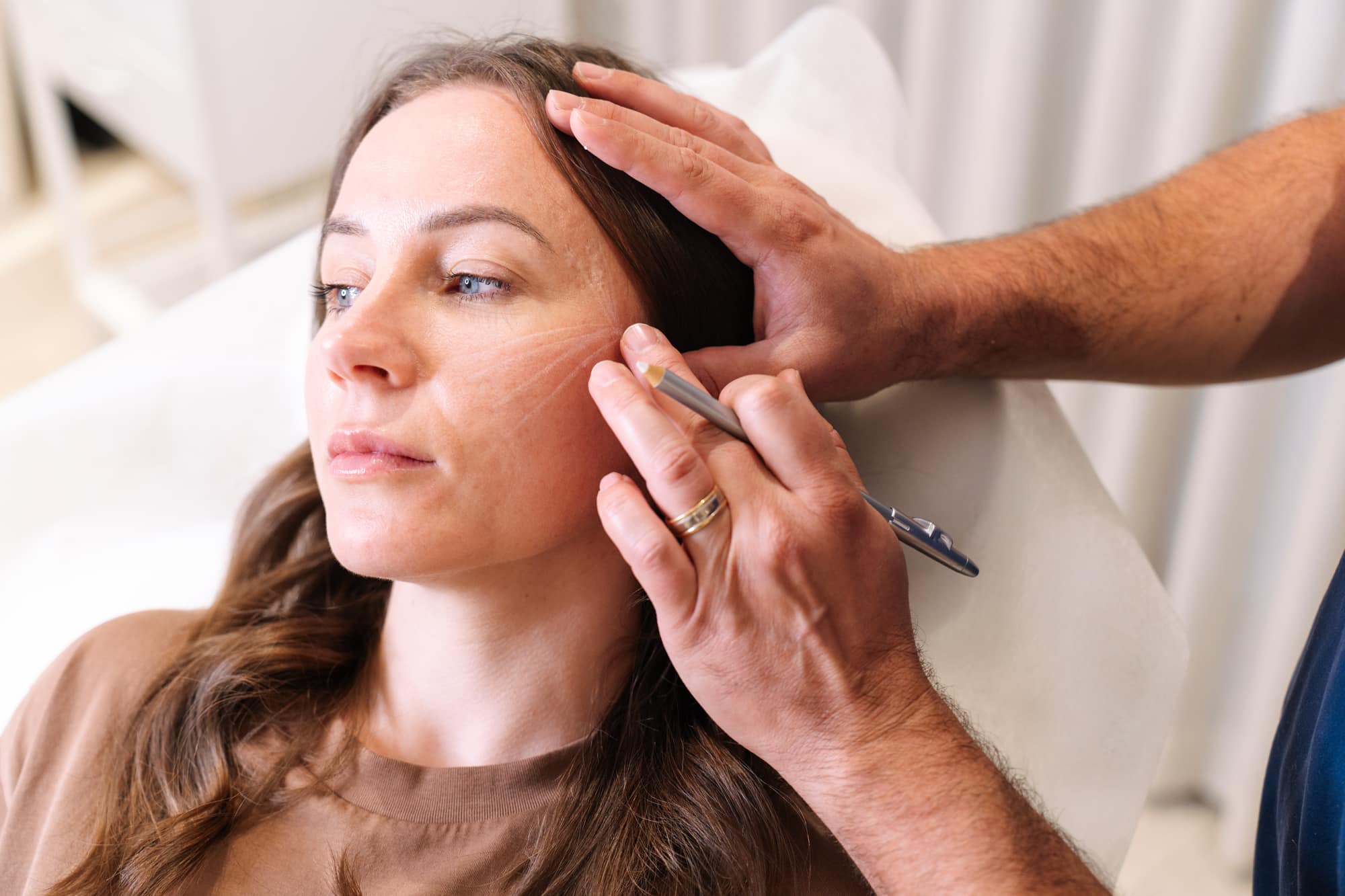 Upper eye filler volumisation procedure at Sydney and Brisbane's leading cosmetic doctors, Contour Clinics