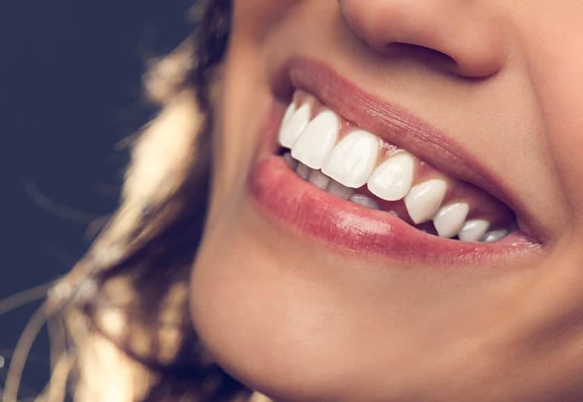 gummy smile treatment